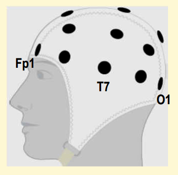 Correct position of Cap