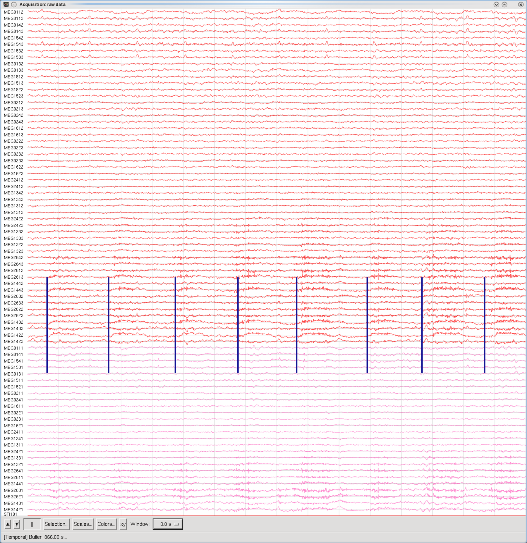 Eyes side-to-side, Temporal set, 8sec Window