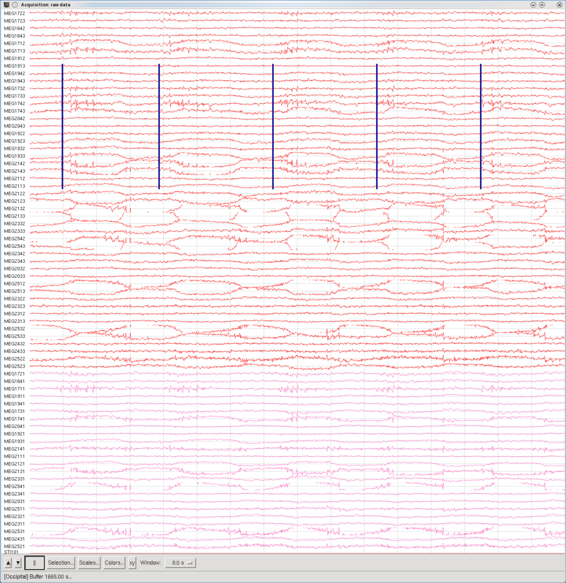 Head movement, Occipital set, 8sec Window