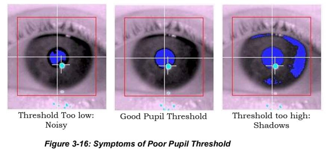 Poor Pupil Threshold