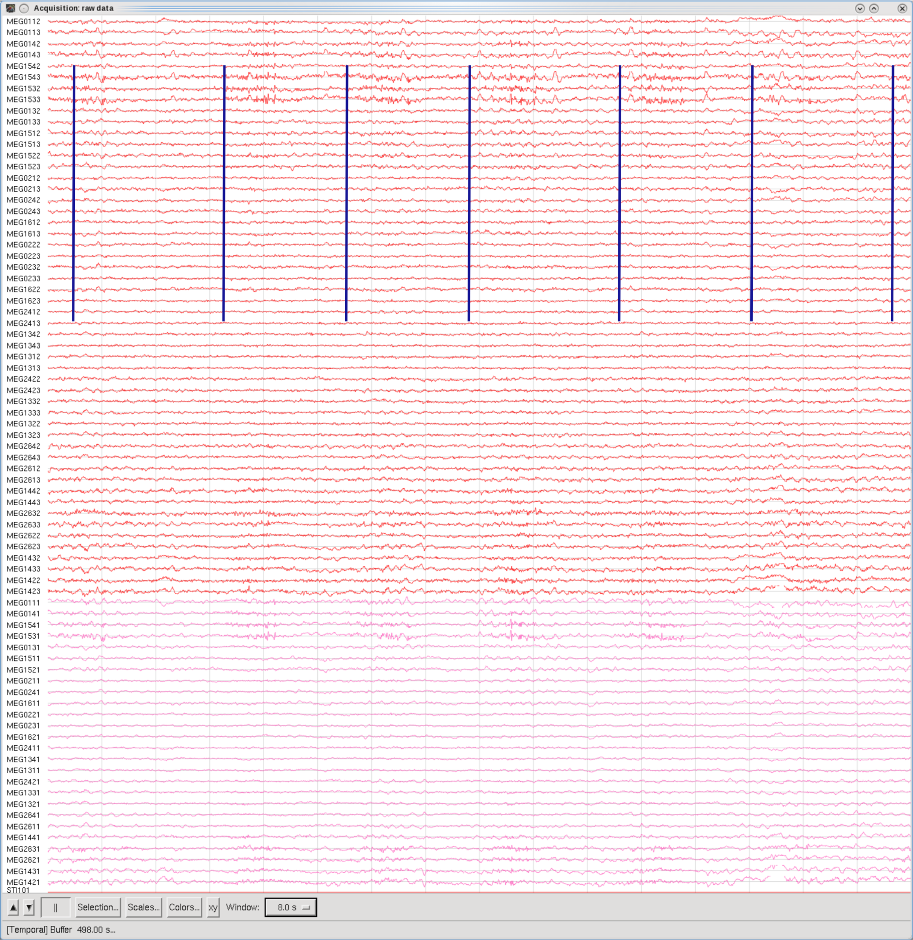 Shrug shoulders, Temporal set, 8sec Window