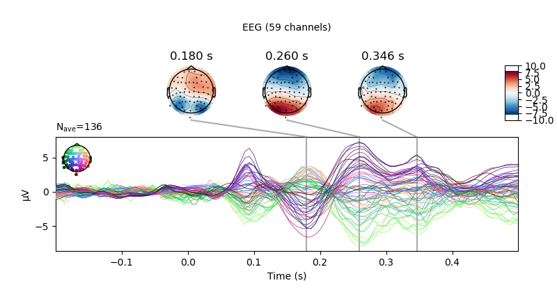An EEG Evoked Response