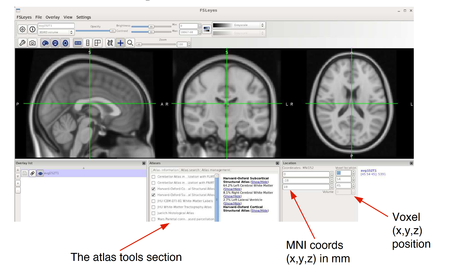 FSLeyes atlas GUI