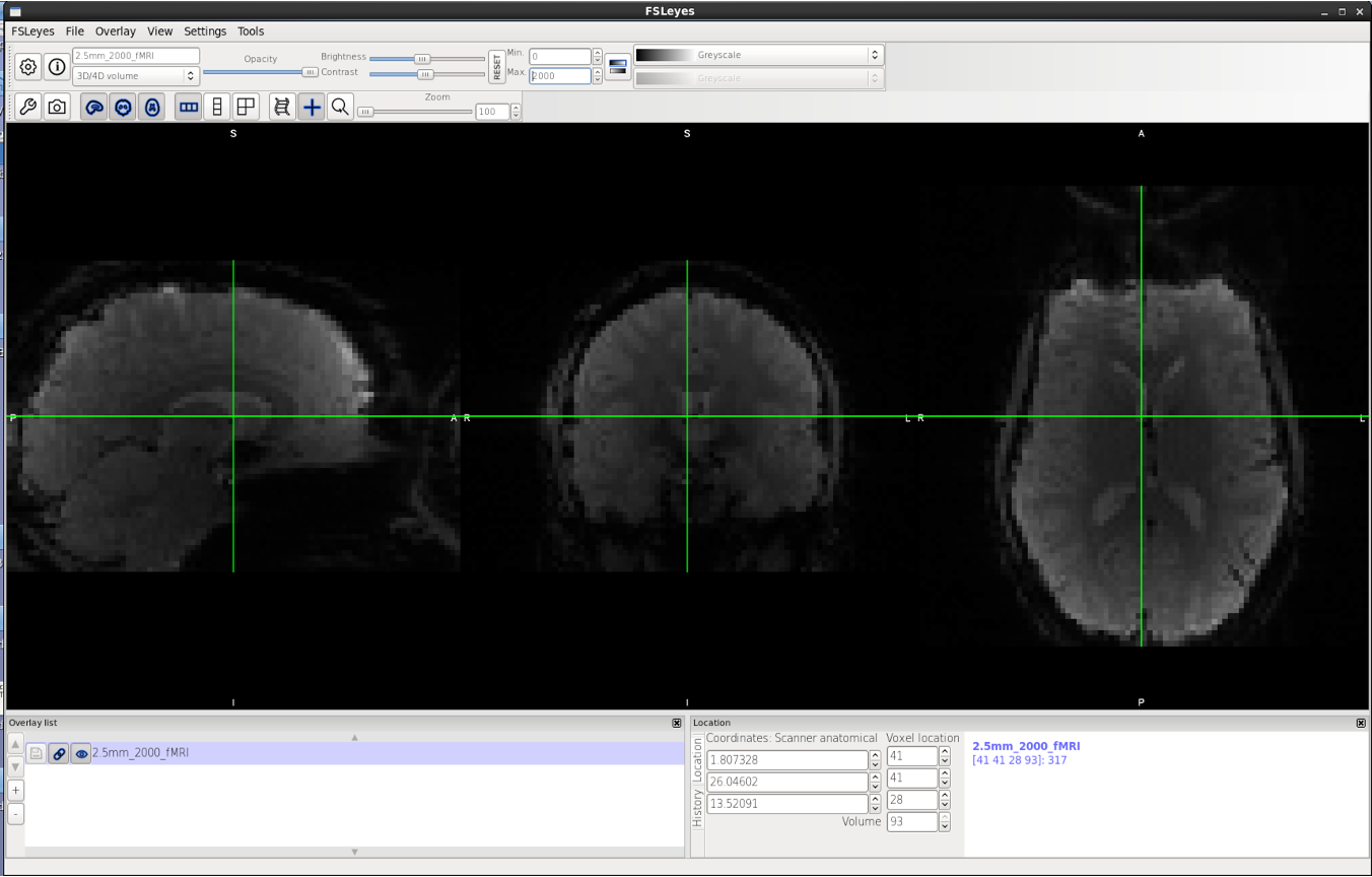 FSLeyes fMRI