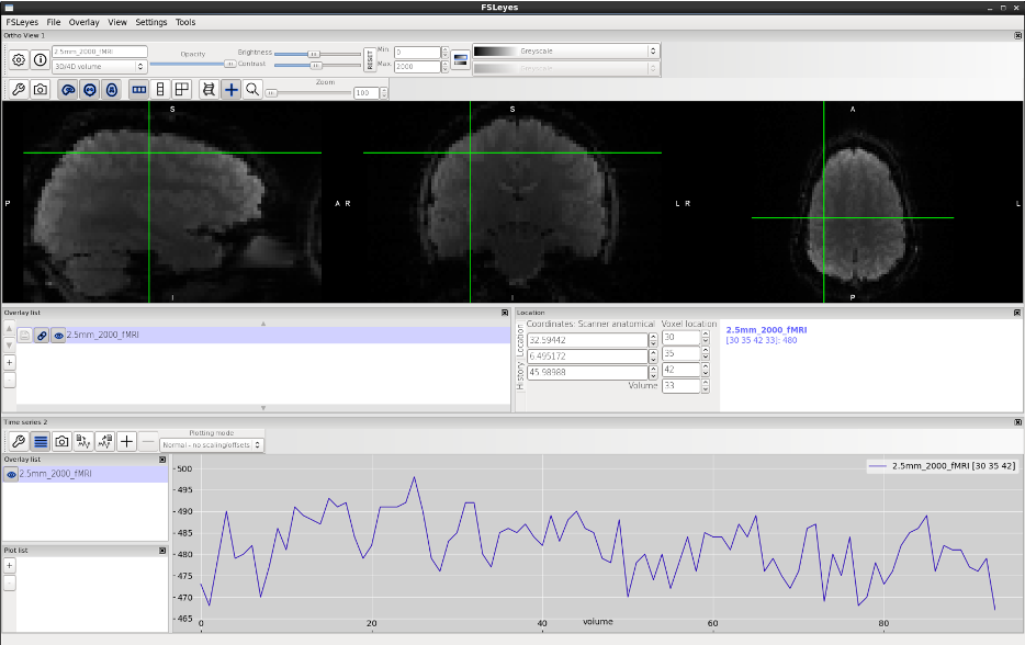 FSLeyes timeseries