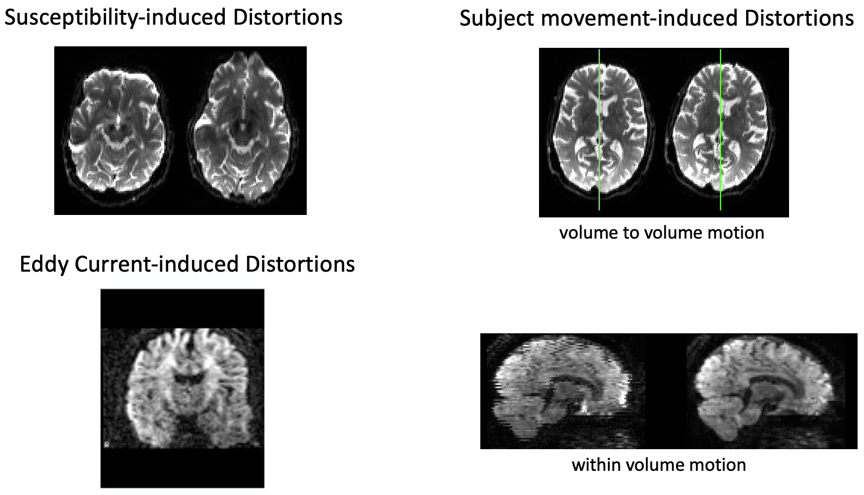 Distortion Types